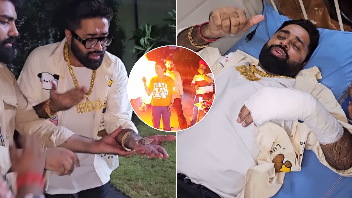 Bigg Boss 17's Sunny Aryaa Burns Hand In Fire Accident After Gas Balloon Explosion, Shares Health Update (VIDEO)